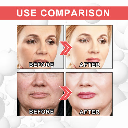 Collagen Boost Anti-Aging Serum – Wrinkle Repair, Skin Firming & Hydrating Collagen Essence